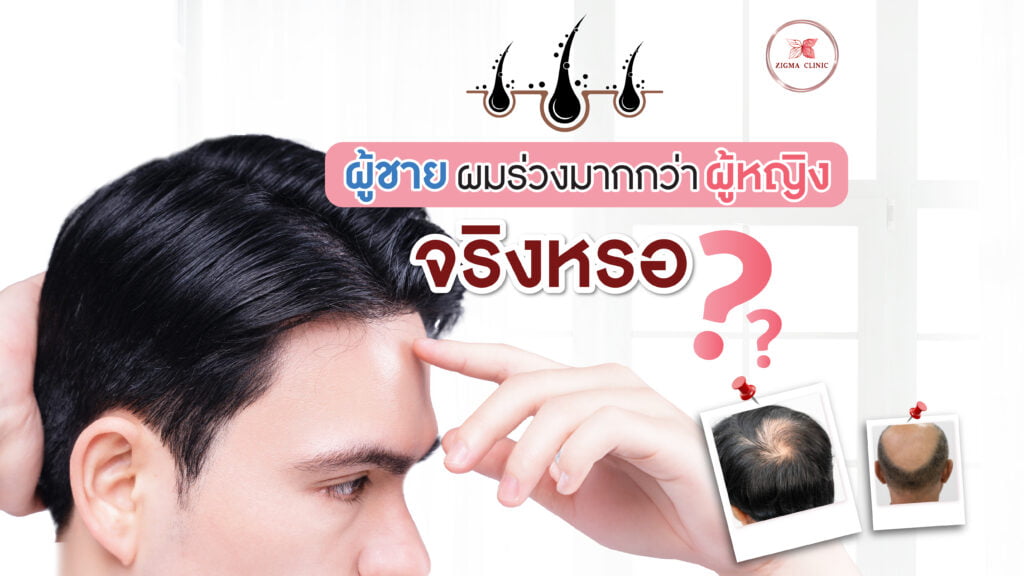 ผู้ชาย ผมร่วง มากกว่าผู้หญิงจริงหรอ